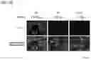 Fig. 16 - Antitumor Agent