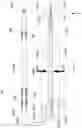 Fig. 11 - Microfluidic sorting using high gradient magnetic fields