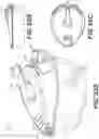 Fig. 65 - Systems and methods for medical device control