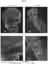 Fig. 20 - MICROGLIA-SUFFICIENT BRAIN ORGANOIDS