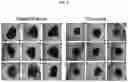 Fig. 26 - MICROGLIA-SUFFICIENT BRAIN ORGANOIDS