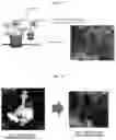 Fig. 02 - DISEASE MODEL