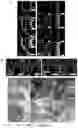 Fig. 09 - CHOROID PLEXUS ORGANOIDS AND METHODS FOR PRODUCTION THEREOF