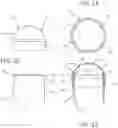 Fig. 05 - Post and cap for chain link fence with enhanced engagement