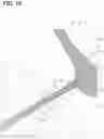 Fig. 11 - Fuel injection valve