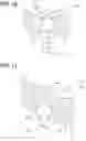 Fig. 10 - Fuel injection valve