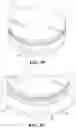 Fig. 07 - Bearing Assembly for Translator of Linear Actuator of Clutch Assembly