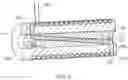 Fig. 03 - PULLEY AND CABLE ARRANGEMENT