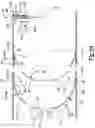 Fig. 12 - Firearm Sound Suppressor