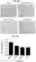 Fig. 14 - METHODS OF TREATING LIVER DISEASES