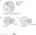 Fig. 04 - METHODS OF DETECTING AND DIAGNOSING DEFECTS OF THE LYMPHATIC VASCULATURE
