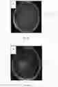 Fig. 03 - Magnetic Resonance Imaging Method Of Generating And Displaying Quantitative T1-Weighted Subtraction Maps (dt1 