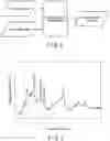 Fig. 03 - MR signal processing apparatus