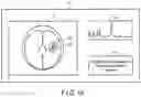 Fig. 17 - MR signal processing apparatus