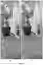 Fig. 06 - Image correction for lasers scanners