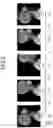Fig. 04 - DEVICE FOR IMAGING, RADIATION IMAGING SYSTEM, AND RECORDING MEDIUM