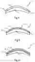 Fig. 03 - Optical system and method for repairing an optical lens of an optical system