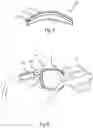 Fig. 04 - Optical system and method for repairing an optical lens of an optical system
