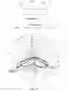 Fig. 17 - Single edge lit lighting module and light fixture producing tailored light distributions
