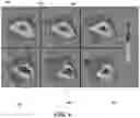 Fig. 07 - Systems and methods for laser scissors and tweezers with a quantitative phase microscope (QPM)