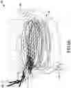 Fig. 15 - Remote-plasma clean (RPC) directional-flow device