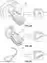 Fig. 03 - POST-MEDICAL-PROCEDURE THERAPY DEVICE MANUFACTURED BASED ON MEDICAL IMAGERY AND CUSTOMIZED INFORMATION OF PATIENT AND METHOD OF MANUFACTURING THE SAME