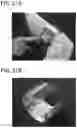 Fig. 22 - ELECTRONIC DEVICE