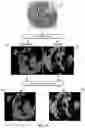 Fig. 08 - TISSUE MICROENVIRONMENT ANALYSIS BASED ON TIERED CLASSIFICATION AND CLUSTERING ANALYSIS OF DIGITAL PATHOLOGY IMAGES