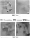 Fig. 10 - TISSUE MICROENVIRONMENT ANALYSIS BASED ON TIERED CLASSIFICATION AND CLUSTERING ANALYSIS OF DIGITAL PATHOLOGY IMAGES