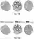 Fig. 11 - TISSUE MICROENVIRONMENT ANALYSIS BASED ON TIERED CLASSIFICATION AND CLUSTERING ANALYSIS OF DIGITAL PATHOLOGY IMAGES