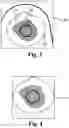 Fig. 04 - Ostomy condition classification with masking, devices and related methods