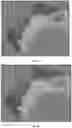 Fig. 06 - Identifying Morphologic, Histopathologic, and Pathologic Features with a Neural Network