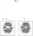 Fig. 04 - Learning device, method, and program, medical image processing apparatus, method, and program, and discriminator