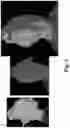Fig. 03 - Dense mesh compression