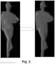 Fig. 04 - Dense mesh compression