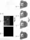Fig. 07 - Video based mesh compression