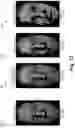 Fig. 13 - Video based mesh compression