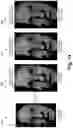 Fig. 15 - Video based mesh compression