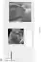 Fig. 12 - Four-dimensional imaging system for cardiovascular dynamics