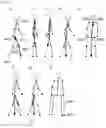 Fig. 18 - System for capturing the movement pattern of a person
