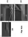 Fig. 08 - METHOD FOR FLATTENING A SURFACE ON AN EPITAXIAL LATERAL GROWTH LAYER