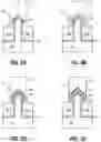 Fig. 18 - DUAL SILICIDE WRAP-AROUND CONTACTS FOR SEMICONDUCTOR DEVICES