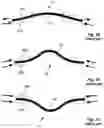 Fig. 10 - PIEZOELECTRIC ACTUATOR AND MICROFLUIDIC DEVICE
