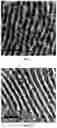 Fig. 08 - Electrode including metal nanoparticles having conductive polymer shell and conductive film and method for manufacturing the same