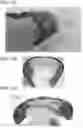 Fig. 18 - Secondary battery and electronic device