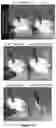 Fig. 23 - Cellulose-based separators comprising flame retardant, and uses thereof in electrochemistry