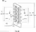 Fig. 22 - Methods for concurrently forming multiple electrical connections in a neuro-monitoring system