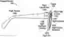 Fig. 01 - Sensor misalignment compensation