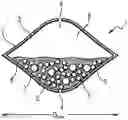 Fig. 01 - Biological Control System Comprising Predator Acarians In A Case