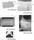 Fig. 02 - PERSONAL PROTECTIVE EQUIPMENT AND METHODS
